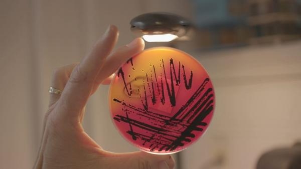 Intoxications alimentaires: menaces dans nos assiettes